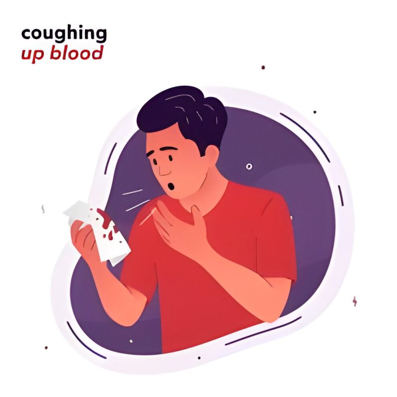 Hemoptysis